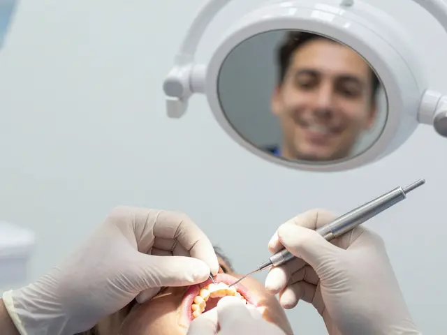 Jaký je proces aplikace fazet na křivé zuby - krok za krokem