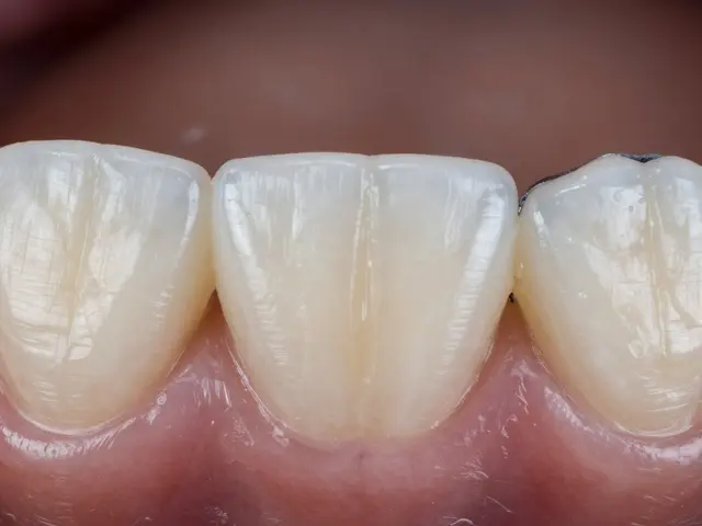 Který los vyhrává? Jak vybrat zirkonovou korunku, která skutečně vydrží