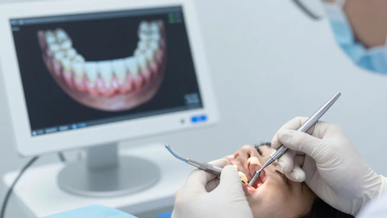 Jak se nasazuje korunka na implantát: krok za krokem