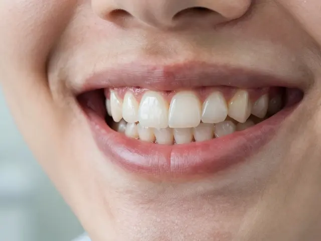 Jak vybělit fazety na přední zuby: průvodce bezpečnými metodami