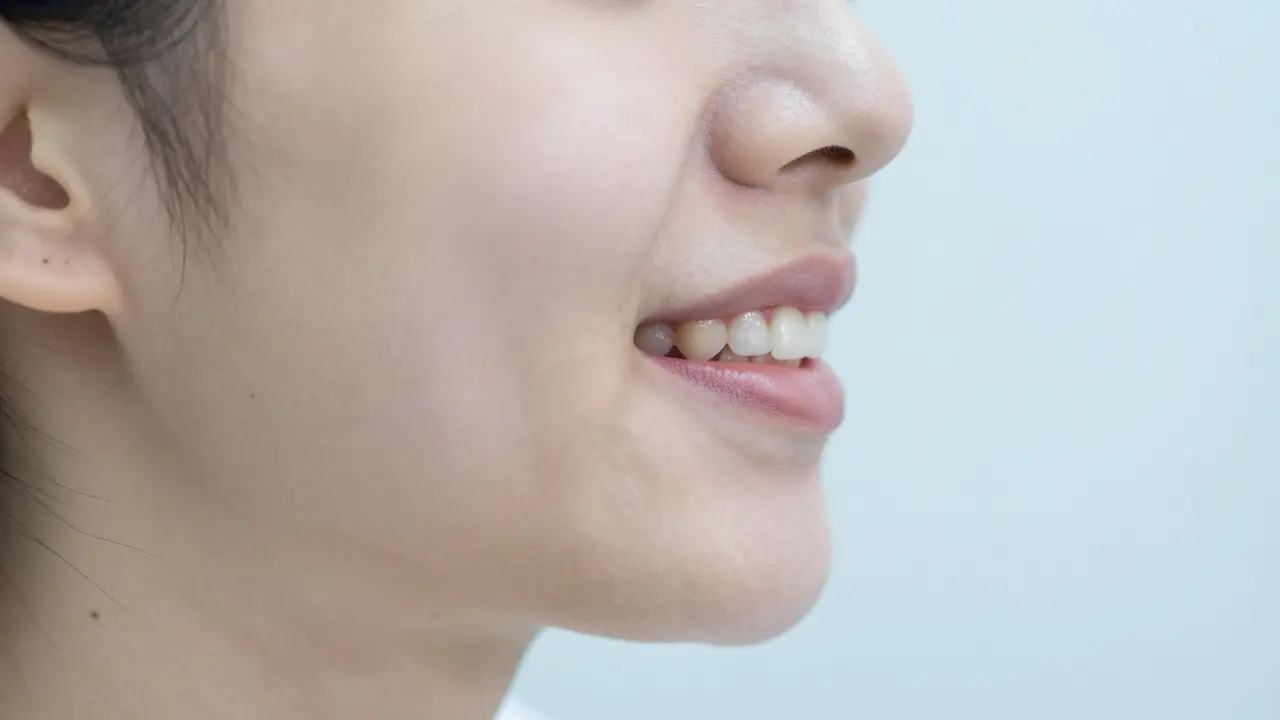 Jak se léčí předkus? Možnosti korekce a výběr nejlepší metody