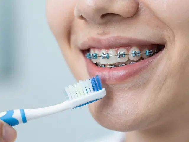 Jak čistit zuby s rovnátkem: Kompletní průvodce pro perfektní hygienu