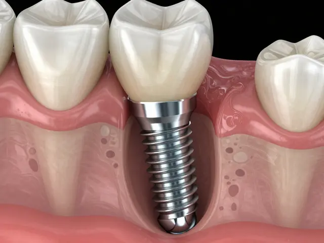 Jak dlouho vydrží zubní implantáty? Realistická životnost a tipy pro péči