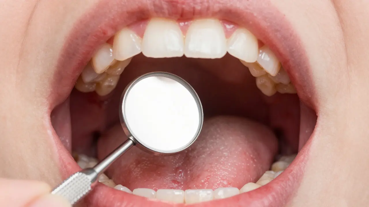Ruка držící dentální zrcátko uvnitř úst pro kontrolu dásní