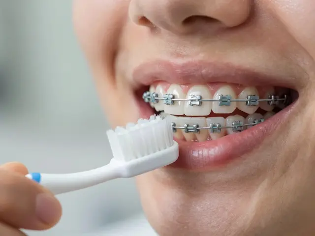 Jak se starat o neviditelná rovnátka: Kompletní průvodce údržbou a hygienou
